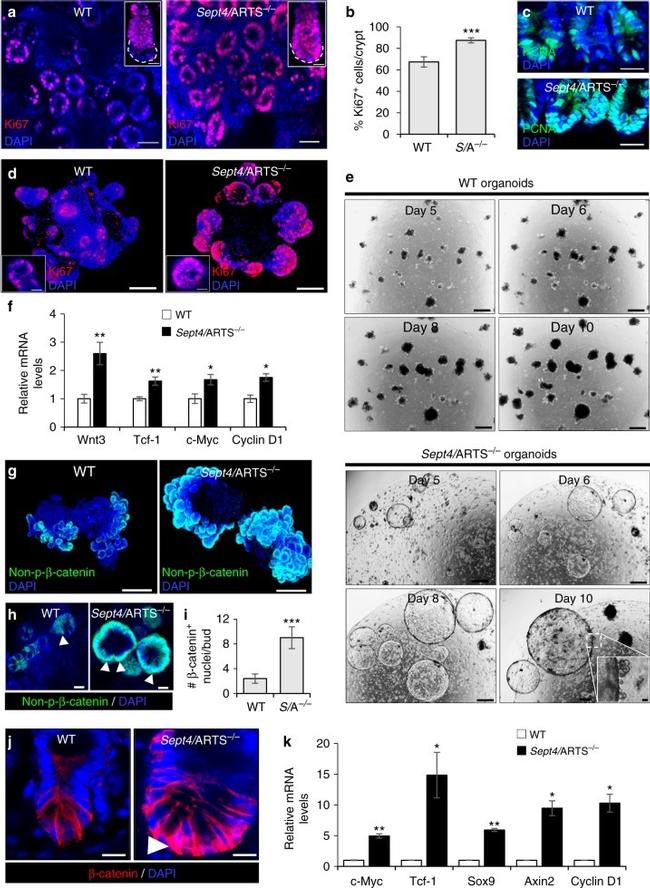 Ki-67 Antibody in Immunohistochemistry (Paraffin) (IHC (P))