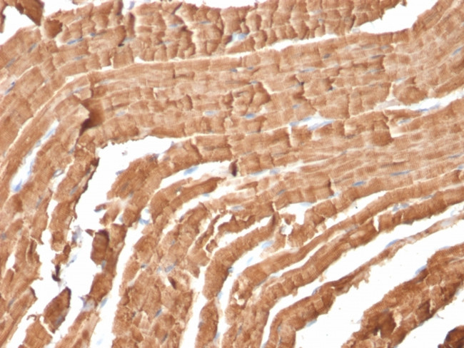 Myoglobin Antibody in Immunohistochemistry (Paraffin) (IHC (P))