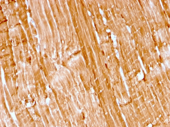 Myoglobin Antibody in Immunohistochemistry (Paraffin) (IHC (P))