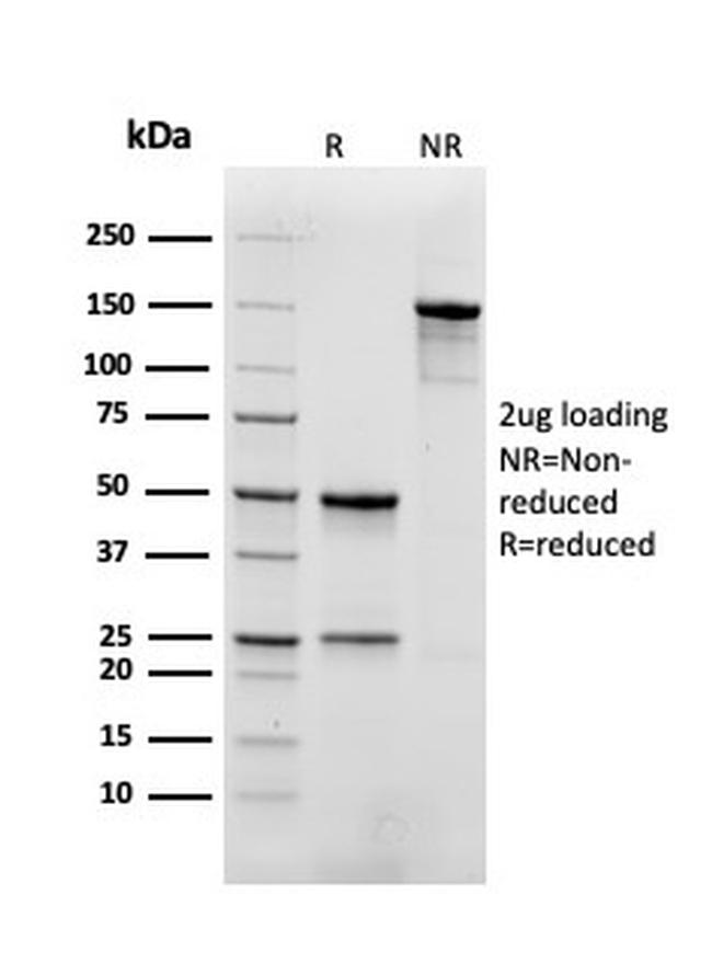 Myoglobin Antibody in SDS-PAGE (SDS-PAGE)