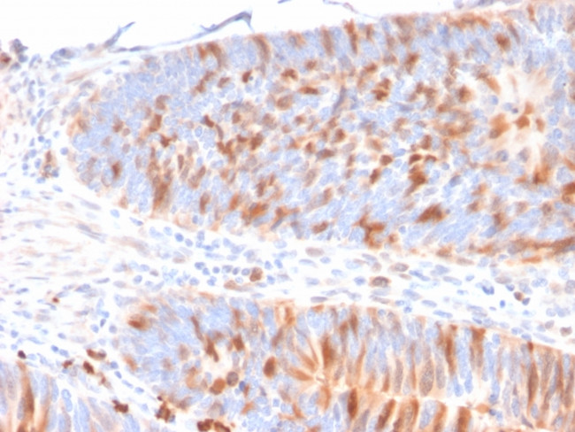 MBD1 (Methyl-CpG Binding Domain Protein 1) Antibody in Immunohistochemistry (Paraffin) (IHC (P))