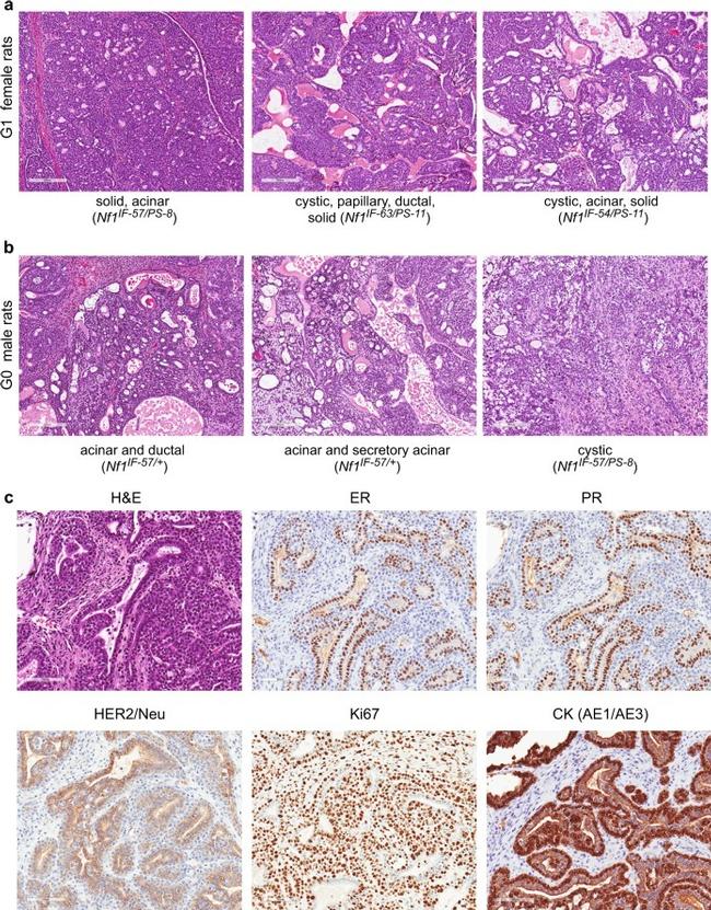 Progesterone Receptor Antibody in Immunohistochemistry (IHC)