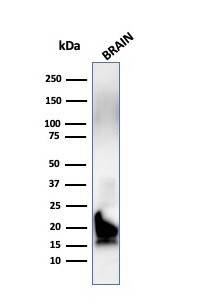Myelin Basic Protein Antibody in Western Blot (WB)