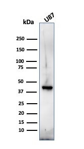Myelin Basic Protein Antibody in Western Blot (WB)