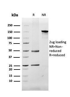 Myelin Basic Protein Antibody in SDS-PAGE (SDS-PAGE)