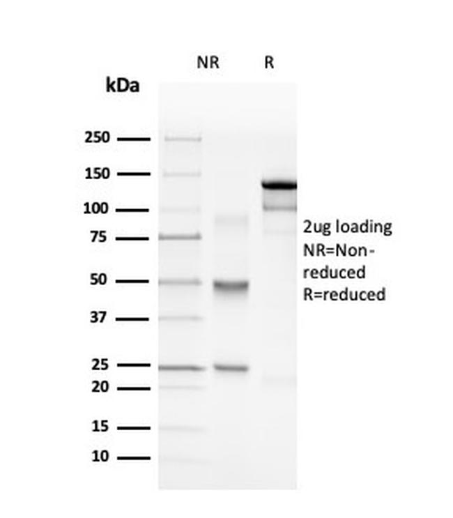 Myelin Basic Protein Antibody in SDS-PAGE (SDS-PAGE)