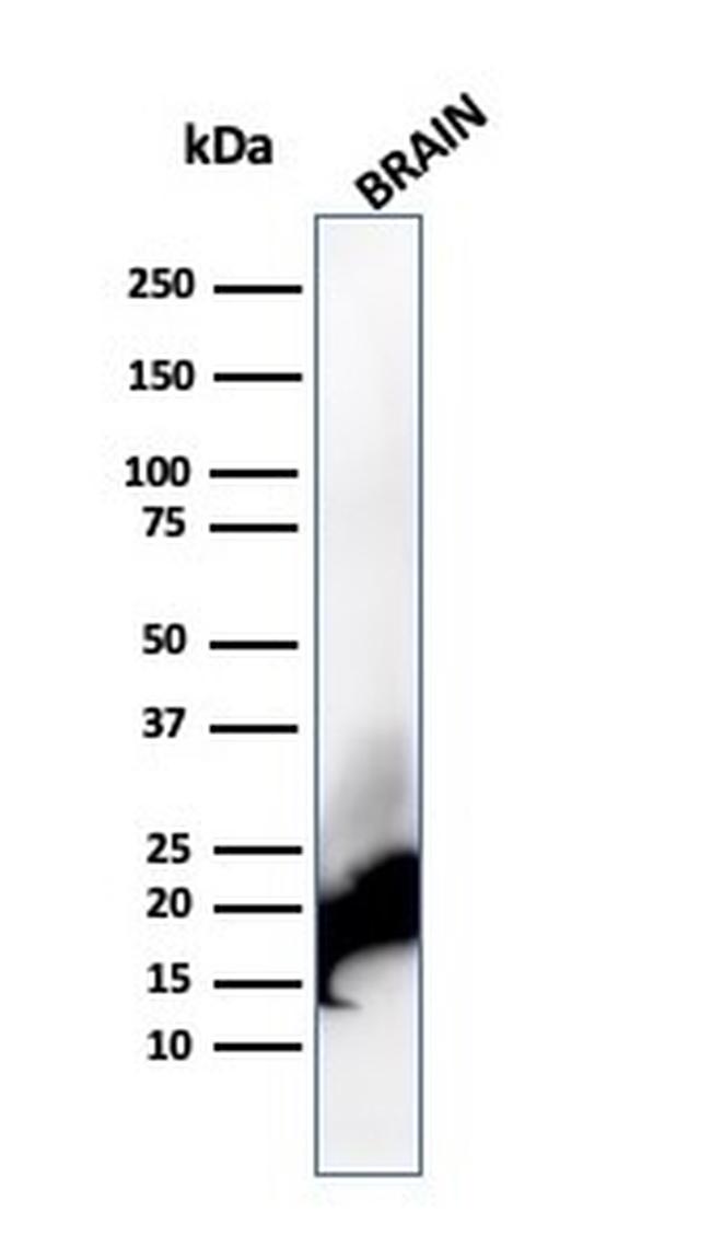 Myelin Basic Protein Antibody in Western Blot (WB)