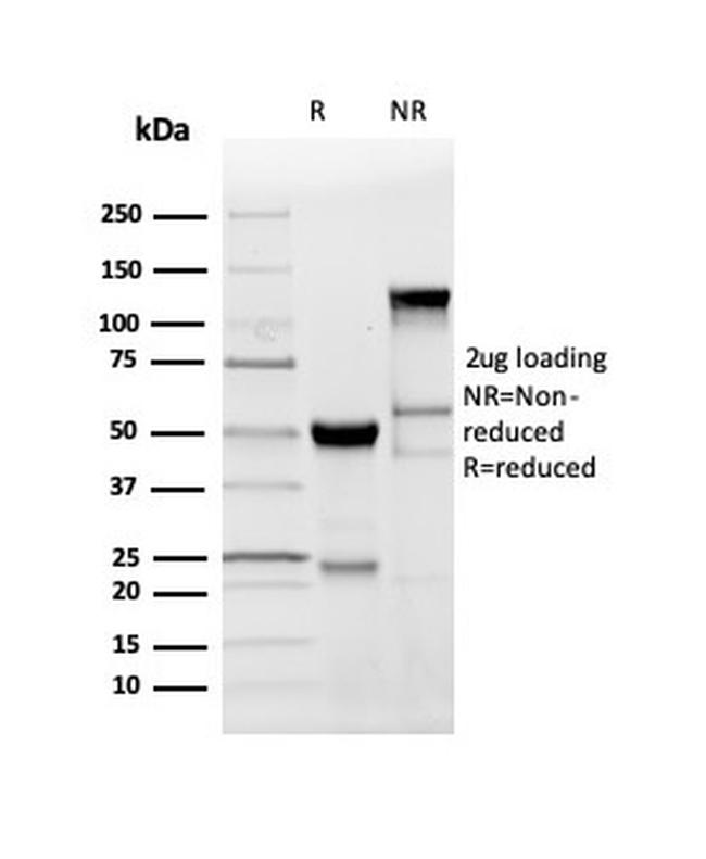 Myelin Basic Protein Antibody in SDS-PAGE (SDS-PAGE)