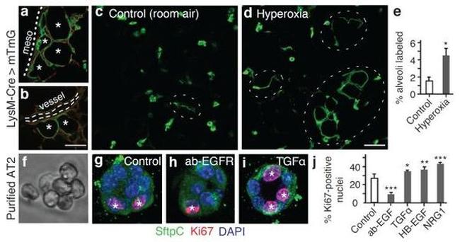 Ki-67 Antibody in Immunocytochemistry (ICC/IF)