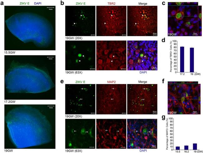 EOMES Antibody in Immunohistochemistry (IHC)