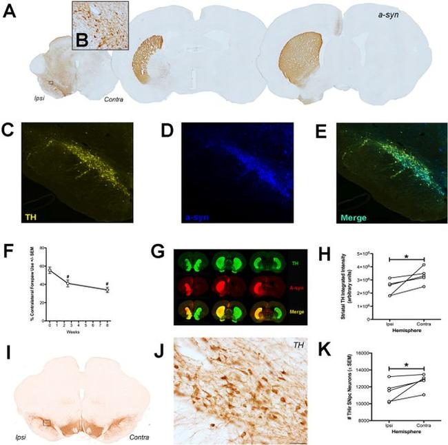 alpha Synuclein Antibody in Immunohistochemistry (IHC)