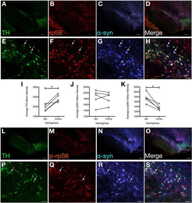 alpha Synuclein Antibody in Immunohistochemistry (IHC)