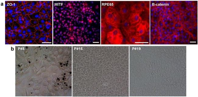 ZO-1 Antibody in Immunocytochemistry (ICC/IF)