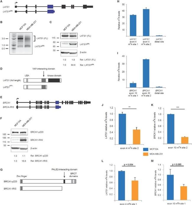 BRCA1 Antibody in Western Blot (WB)