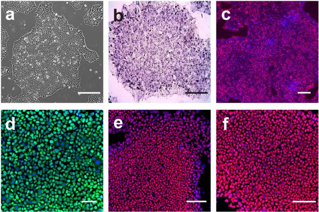 Nanog Antibody in Immunocytochemistry, Immunohistochemistry (ICC/IF, IHC)