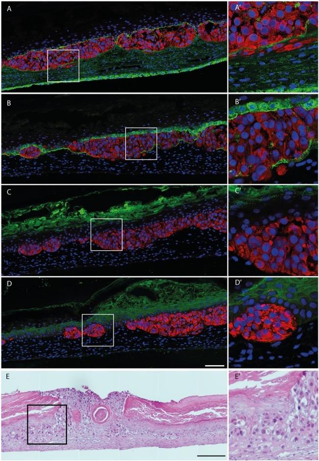 PMEL Antibody in Immunohistochemistry (IHC)