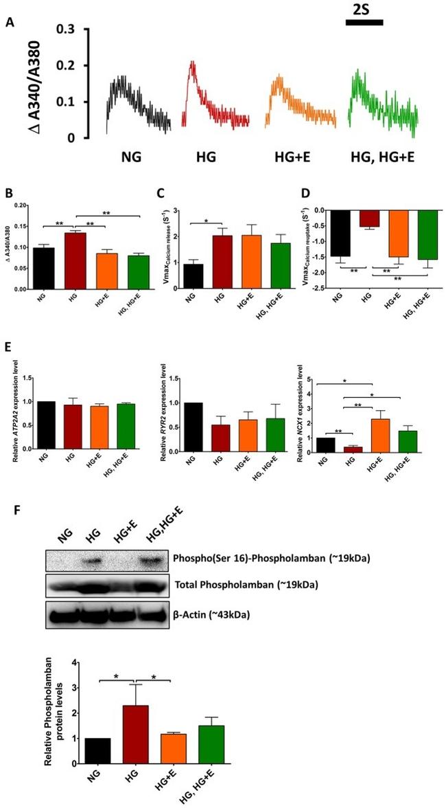 Phospholamban Antibody in Western Blot (WB)