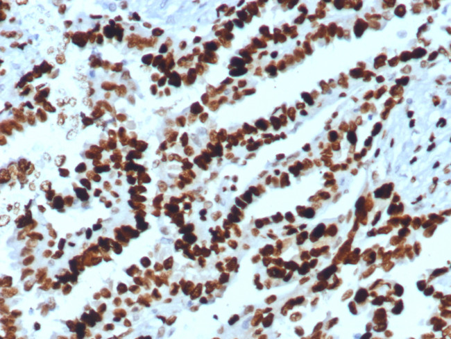 MCM2 (Proliferation Marker) Antibody in Immunohistochemistry (Paraffin) (IHC (P))