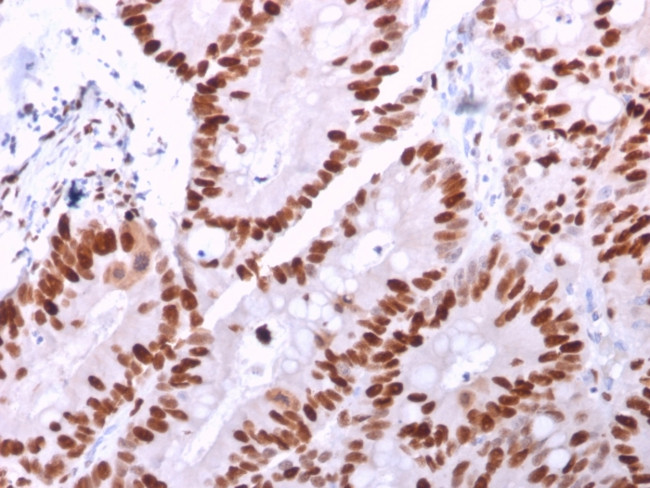 MCM6 (Proliferation Marker) Antibody in Immunohistochemistry (Paraffin) (IHC (P))