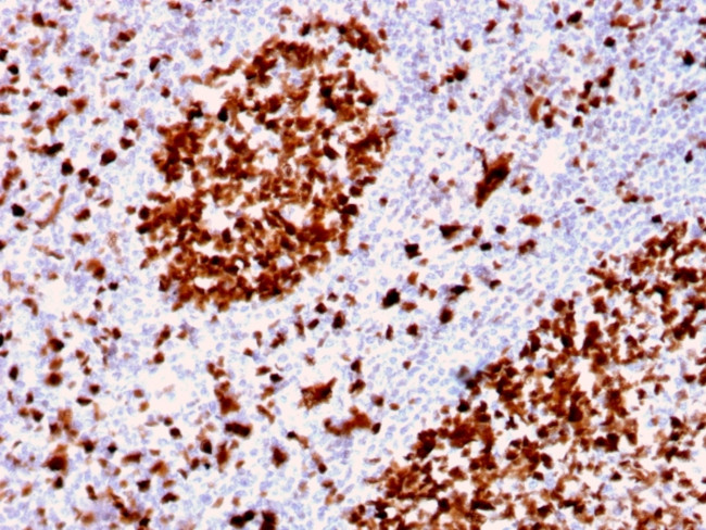 MCM6 (Proliferation Marker) Antibody in Immunohistochemistry (Paraffin) (IHC (P))