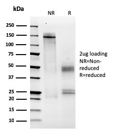 MCM6 (Proliferation Marker) Antibody in SDS-PAGE (SDS-PAGE)
