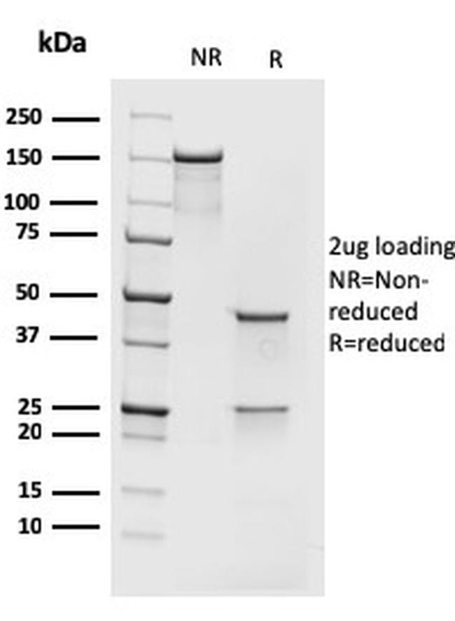 MCM7 Antibody in SDS-PAGE (SDS-PAGE)