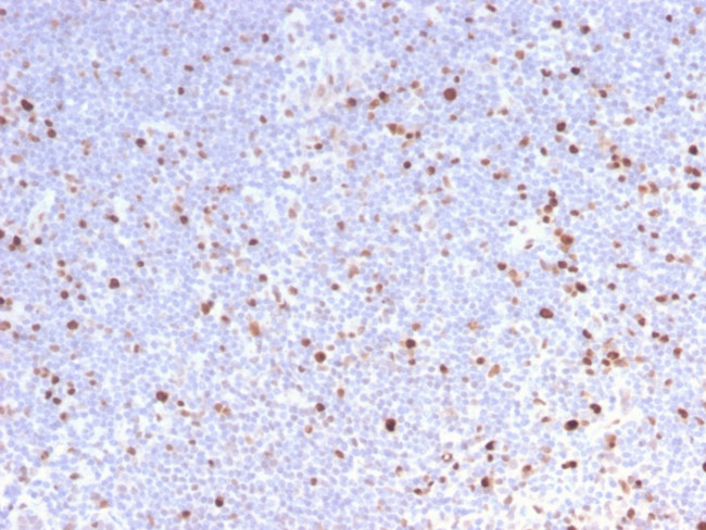 MCM7 Antibody in Immunohistochemistry (Paraffin) (IHC (P))