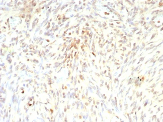 MDM2 Antibody in Immunohistochemistry (Paraffin) (IHC (P))