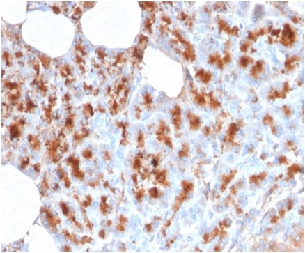 MDM2 Antibody in Immunohistochemistry (Paraffin) (IHC (P))