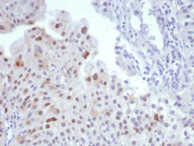 MDM2 Antibody in Immunohistochemistry (Paraffin) (IHC (P))