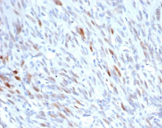 MDM2 Antibody in Immunohistochemistry (Paraffin) (IHC (P))