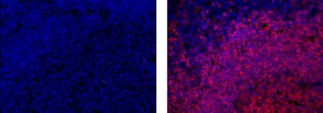 CD20 Antibody in Immunohistochemistry (Paraffin) (IHC (P))