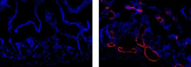 LYVE1 Antibody in Immunohistochemistry (Frozen) (IHC (F))