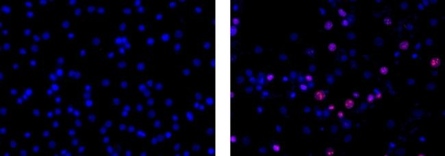 Rat IgG1 kappa Isotype Control in Immunocytochemistry (ICC/IF)