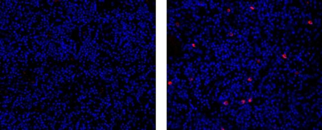 Rat IgG1 kappa Isotype Control in Immunohistochemistry (Paraffin) (IHC (P))