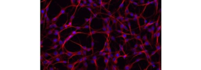 alpha Tubulin Antibody in Immunocytochemistry (ICC/IF)