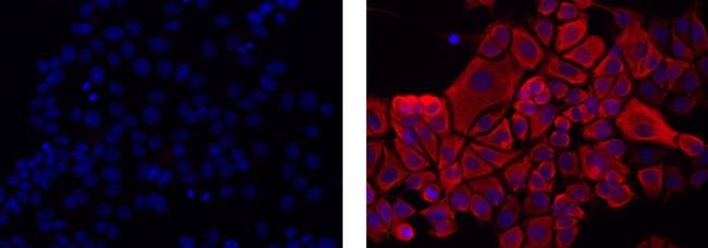 Mouse IgG1 kappa Isotype Control in Immunocytochemistry (ICC/IF)