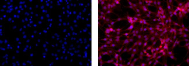 Mouse IgG1 kappa Isotype Control in Immunocytochemistry (ICC/IF)