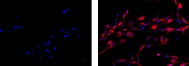 Mouse IgG1 kappa Isotype Control in Immunocytochemistry (ICC/IF)