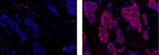 Mouse IgG1 kappa Isotype Control in Immunohistochemistry (Paraffin) (IHC (P))