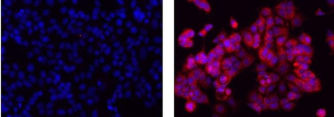 Mouse IgG2b kappa Isotype Control in Immunocytochemistry (ICC/IF)