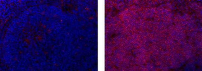 Rat IgG2a Secondary Antibody in Immunohistochemistry (Frozen) (IHC (F))