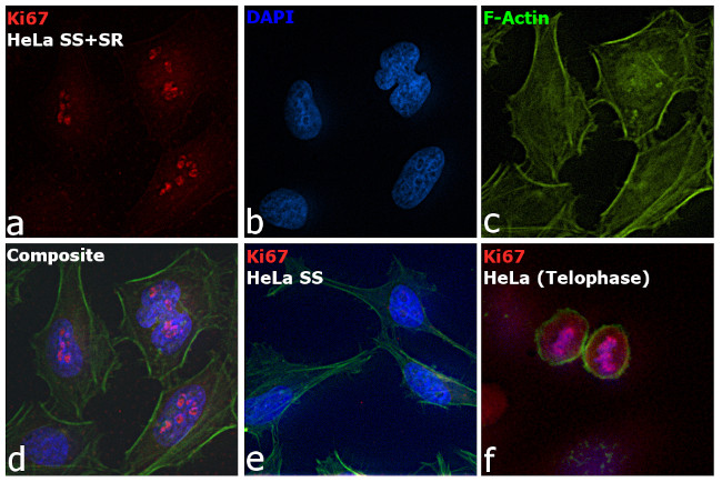 Ki-67 Antibody in Immunocytochemistry (ICC/IF)