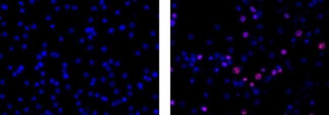 Ki-67 Antibody in Immunocytochemistry (ICC/IF)