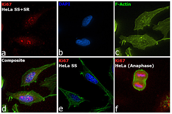 Ki-67 Antibody