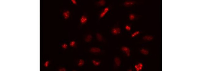 Ki-67 Antibody in Immunocytochemistry (ICC/IF)