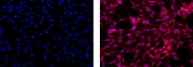 GFAP Antibody in Immunocytochemistry (ICC/IF)