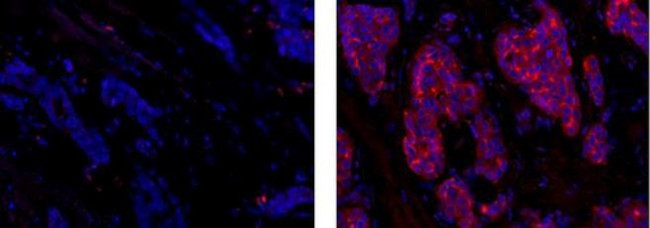 CD227 (Mucin 1) Antibody in Immunohistochemistry (Paraffin) (IHC (P))