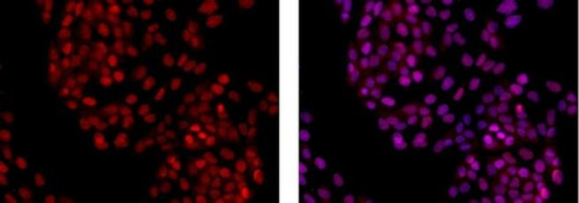 PCNA Antibody in Immunocytochemistry (ICC/IF)