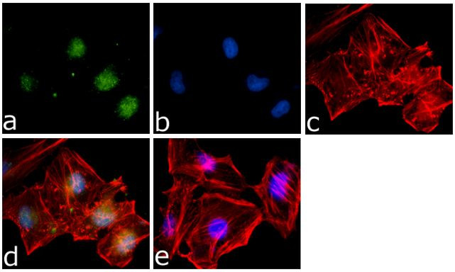 SMAD7 Antibody in Immunocytochemistry (ICC/IF)